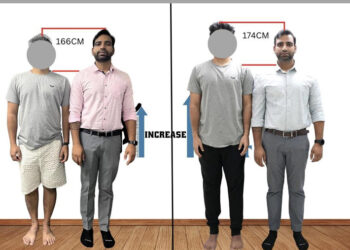 Painful yet effective way to add few more inches to your height through Limb Lengthening in India