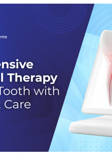 Comprehensive Root Canal Therapy at Dent Eazee: Save Your Tooth with Our Expert Care