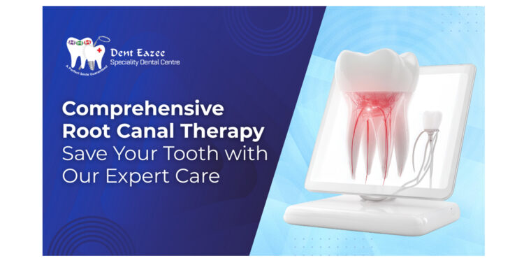 Comprehensive Root Canal Therapy at Dent Eazee: Save Your Tooth with Our Expert Care